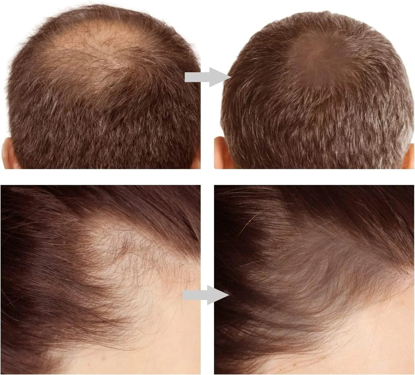 Natural Hairline Powder Stick.